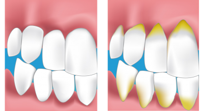 Paradontie Dentiste Paris 15 eme